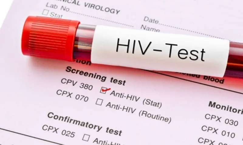 Xét nghiệm HIV sớm